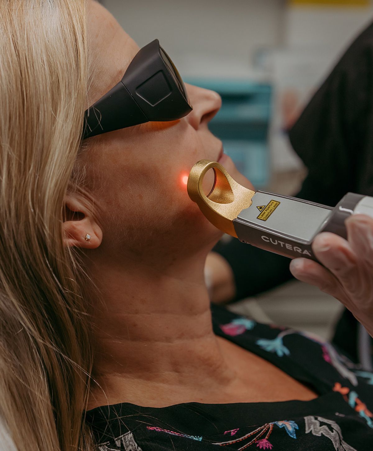 Woman receiving laser treatment on her face.