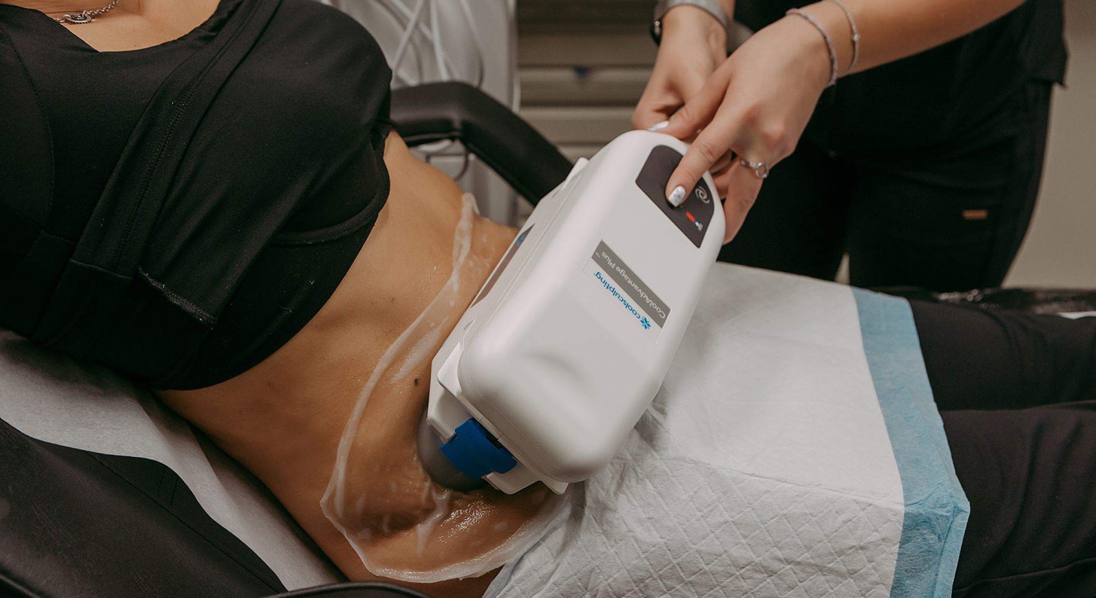 CoolSculpting treatment in progress on abdomen.